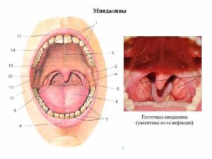 Дырка на небно глоточной дужке болит