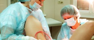 Месячные после операции