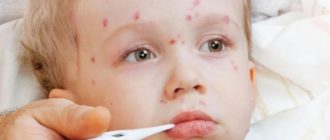 Можно ли заразиться от больного ребенка