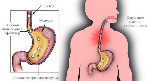 Чувствую пищевод и желудок