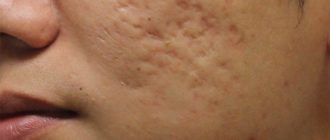 Можно ли избавиться от перебоев