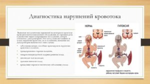 Нарушение кровотока при беременности