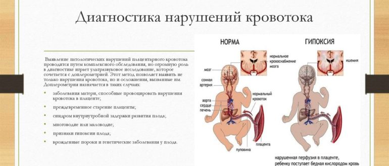 Нарушение кровотока при беременности