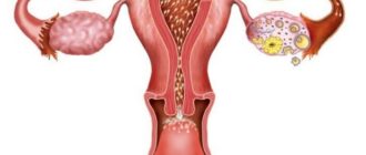 Может ли наступить беременность?