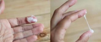 Выделения как яичный белок