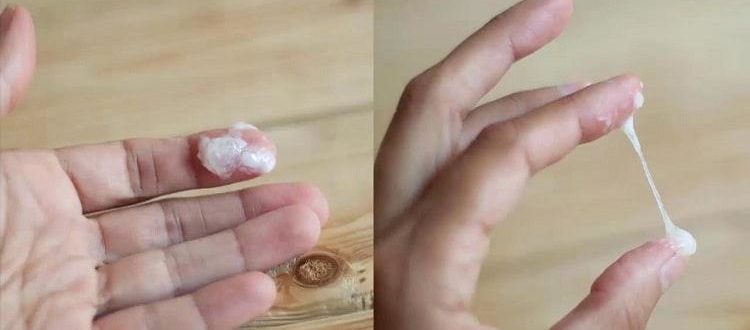 Выделения как яичный белок