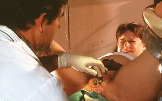 ЭПИЗИОТОМИЯ, ПОСЛЕДСТВИЯ