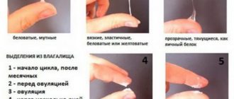 Выделения на протяжении всего цикла!