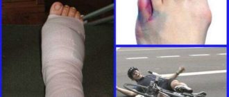 Можно ли погнуть титановые спицы в руке при падении?