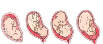 Краевое предлежание плаценты на 23 неделе