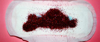 Выделение крови не месячные