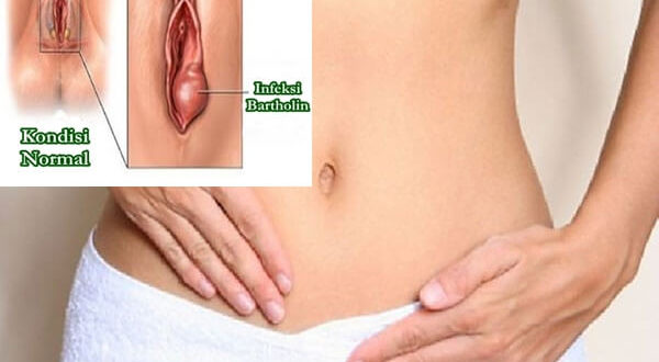 Воспалилась половая губа с правой стороны