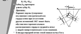 Эос отклонена влево у ребёнка