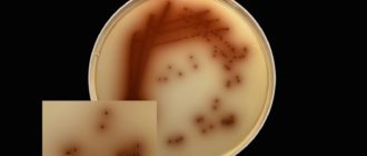 E. faecalis - 10^7 КОЕ