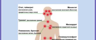 Диабет 2 типа осложнение после гриппа