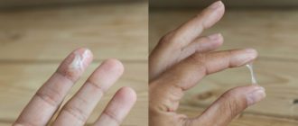 Выделения в середине цикла