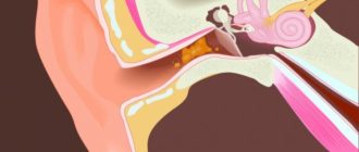 Воск попал в ухо