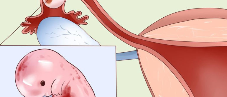 Могу ли я быть беременна после гидротубации