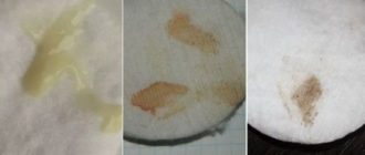 Выделения за 2 недели до месячных