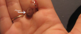 Второй выкидыши подряд