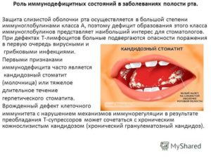 Вопрос о состоянии слизистой оболочки рта