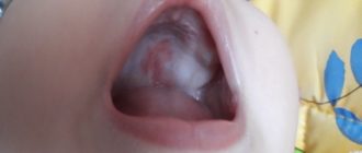 На нёбе синее пятно