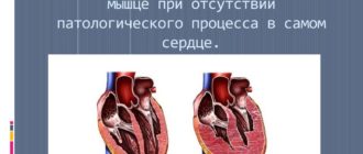 Миокардиодистрофия?