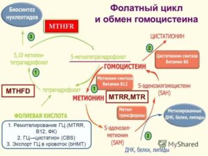 Дефицит фолатного цикла