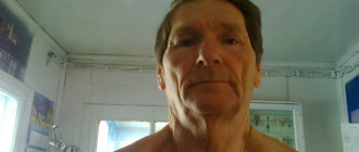 Допустим ли приём изолята сывороточного протеина после шунтирования на сердце