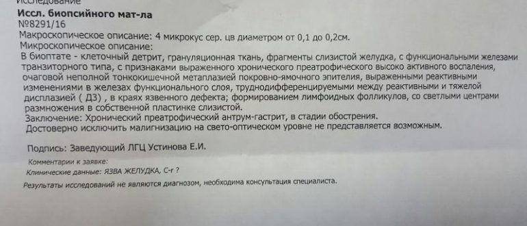 Что означают результаты биопсии и посоветуйте схему(лекарства) лечения