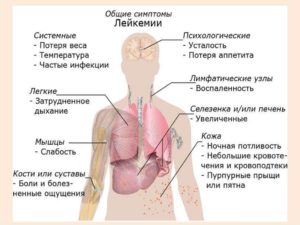 Может ли быть лейкоз