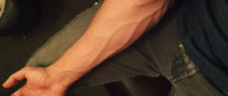 Видны вены на руках