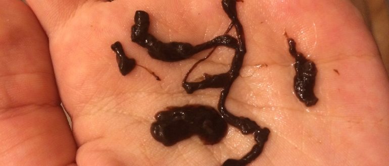 Месячные стали гуще