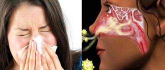 Долго не могу чихнуть, в носу щекотно
