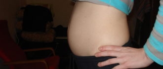 Выпирает живот и он очень твердый, что это такое?