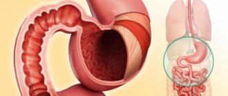 Дуоденит, недостаточность кардии