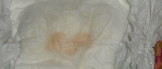 Выделения у мальчика