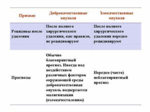 Возможен ли рецидив доброкачественной опухоли