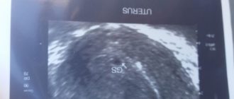 Можно ли идти на узи при 3 днях задержки