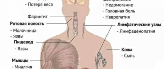 Молочница - признак ВИЧ?