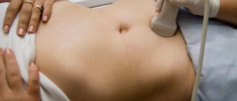 Узи малого таза при молочнице?