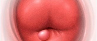 Наботова киста в передней губе