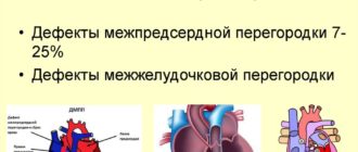 Врожденный порок сердца- ООО