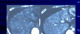 Узлы регенерации