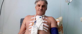 Через какой период после АКШ можно делать каронографию сердца пвторно