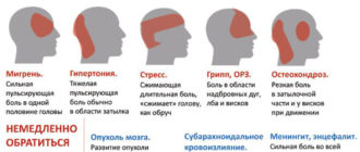 Частые головные боли в лобной области в весках