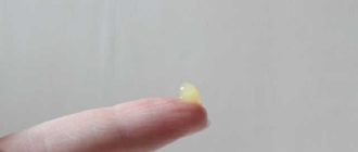 Выделения из заднего прохода