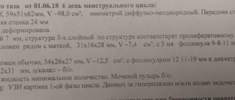 УЗИ малого таза на 7-8 день цикла