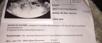 Могут ли врачи ошибиться в сроках беременности