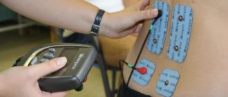 Электростимуляция мышц спины